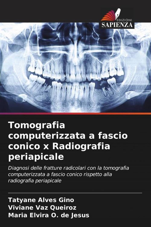 Produktbild: Tomografia computerizzata a fascio conico x Radiografia periapicale