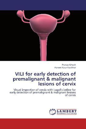 Produktbild: Ghosh, P: VILI for early detection of premalignant & maligna