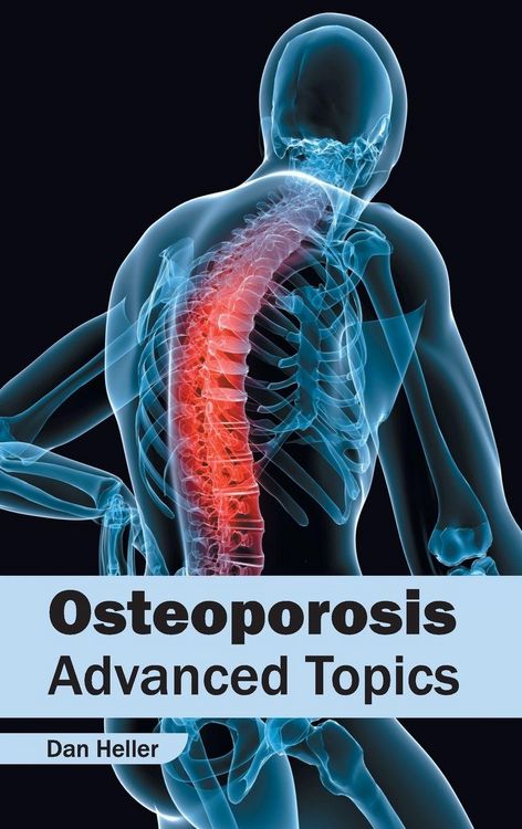 Produktbild: Osteoporosis