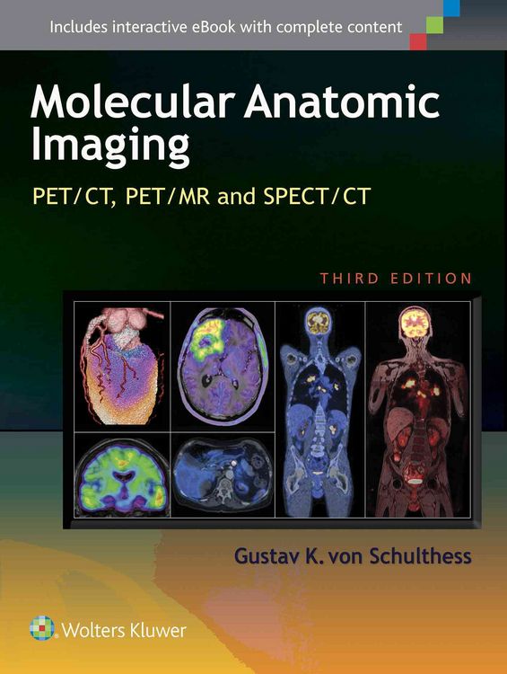 Produktbild: Von Schulthess, G: Molecular Anatomic Imaging