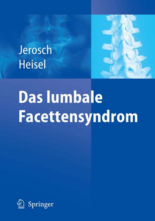 Produktbild: Das lumbale Facettensyndrom