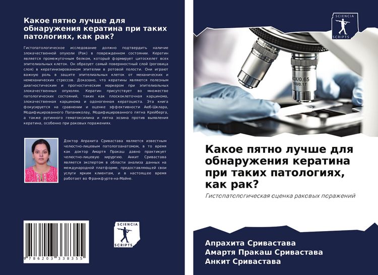 Produktbild: Kakoe pqtno luchshe dlq obnaruzheniq keratina pri takih patologiqh, kak rak?