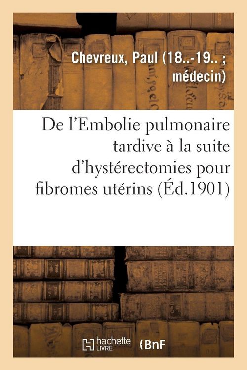 Produktbild: De l'Embolie pulmonaire tardive &agrave; la suite d'hyst&eacute;rectomies pour fibromes ut&eacute;rins
