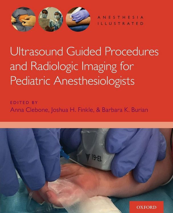 Produktbild: Ultrasound Ai P