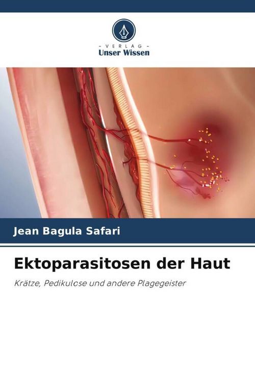 Produktbild: Ektoparasitosen der Haut