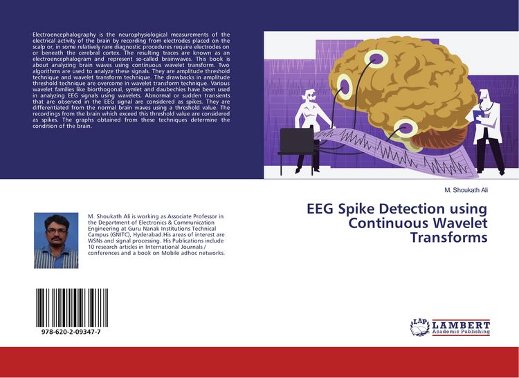 Produktbild: EEG Spike Detection using Continuous Wavelet Transforms
