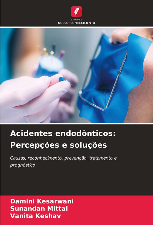 Produktbild: Acidentes endod&ocirc;nticos: Percep&ccedil;&otilde;es e solu&ccedil;&otilde;es