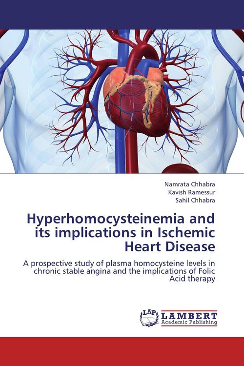 Produktbild: Hyperhomocysteinemia and its implications in Ischemic Heart Disease
