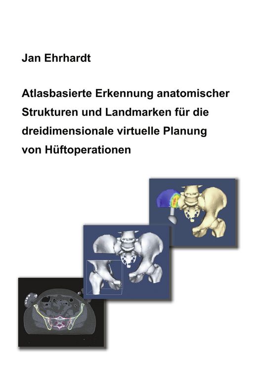 Produktbild: Atlasbasierte Erkennung anatomischer Strukturen und Landmarken für die dreidimensionale virtuelle Planung von Hüftoperationen
