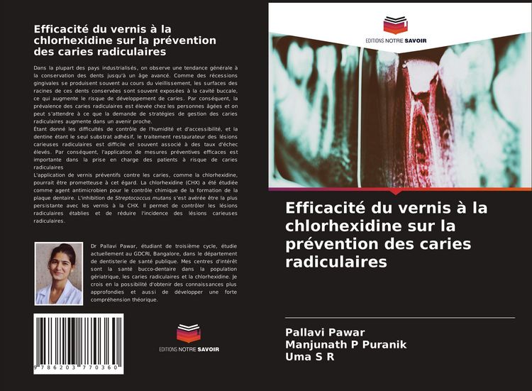 Produktbild: Efficacit&eacute; du vernis &agrave; la chlorhexidine sur la pr&eacute;vention des caries radiculaires