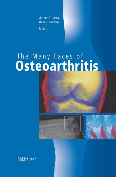 Produktbild: The Many Faces of Osteoarthritis