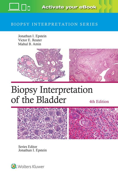 Produktbild: Biopsy Interpretation of the Bladder: Print + eBook with Multimedia