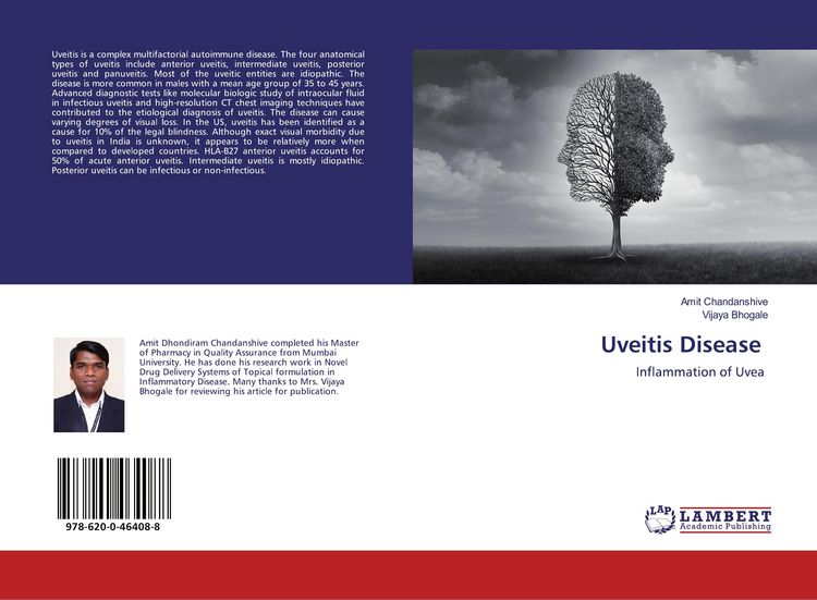Produktbild: Uveitis Disease