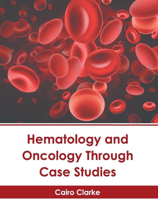 Produktbild: Hematology and Oncology Through Case Studies