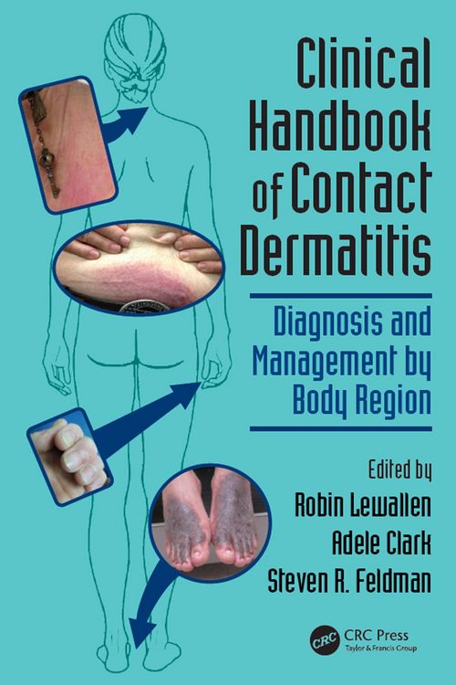 Produktbild: Clinical Handbook of Contact Dermatitis