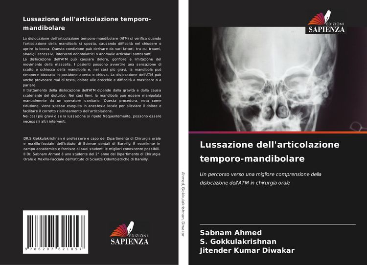 Produktbild: Lussazione dell'articolazione temporo-mandibolare