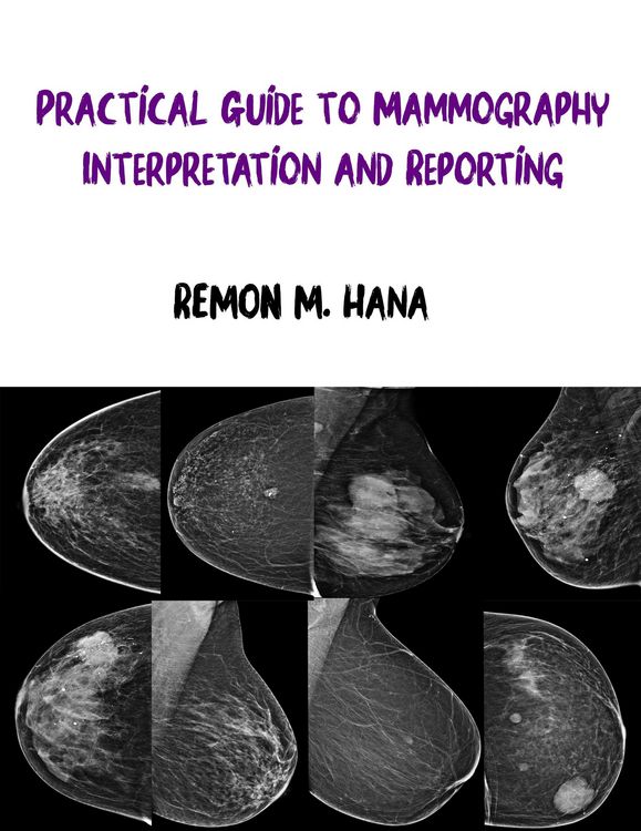 Produktbild: Practical Guide to Mammography Interpretation and Reporting