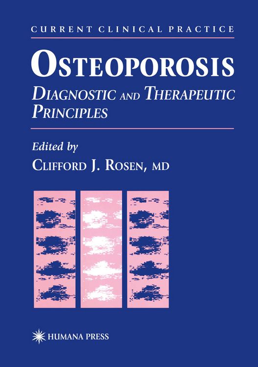 Produktbild: Osteoporosis