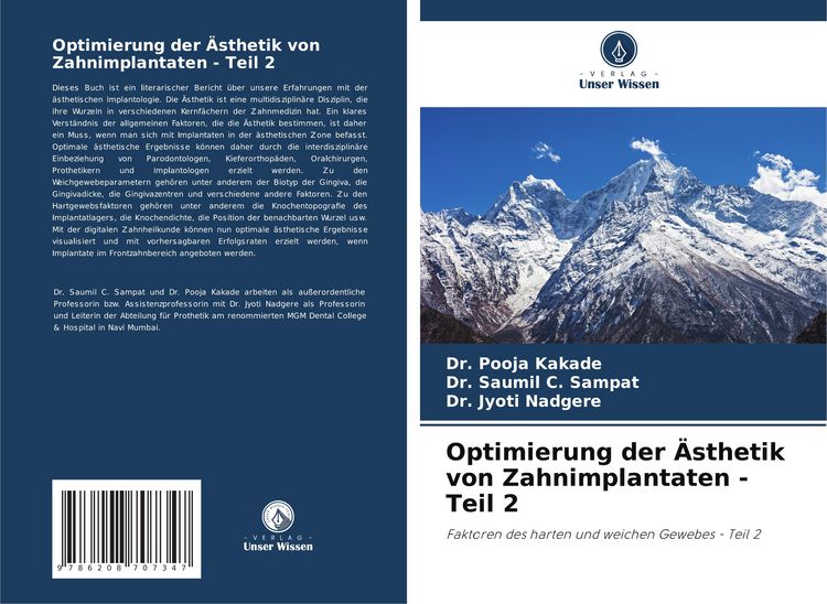 Produktbild: Optimierung der &Auml;sthetik von Zahnimplantaten - Teil 2