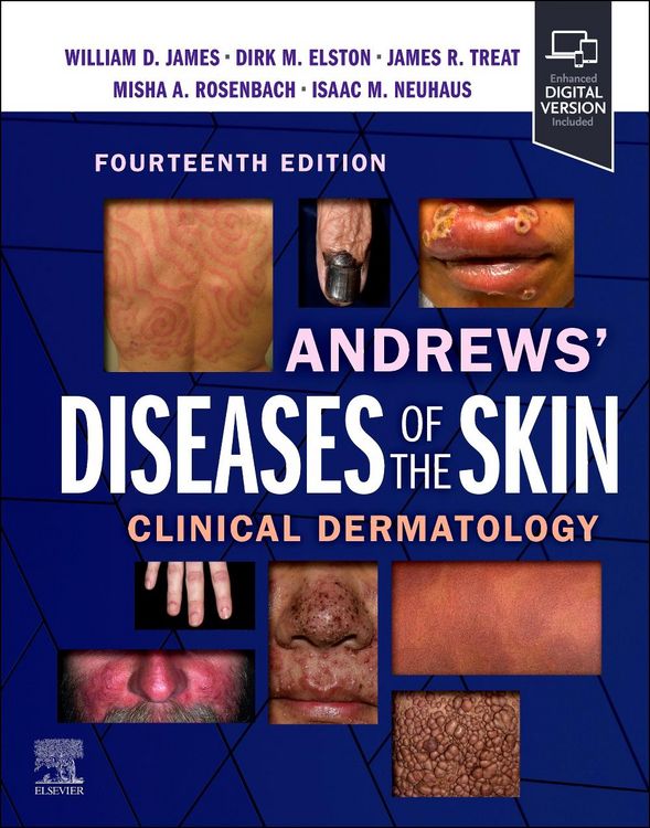 Produktbild: Andrews' Diseases of the Skin