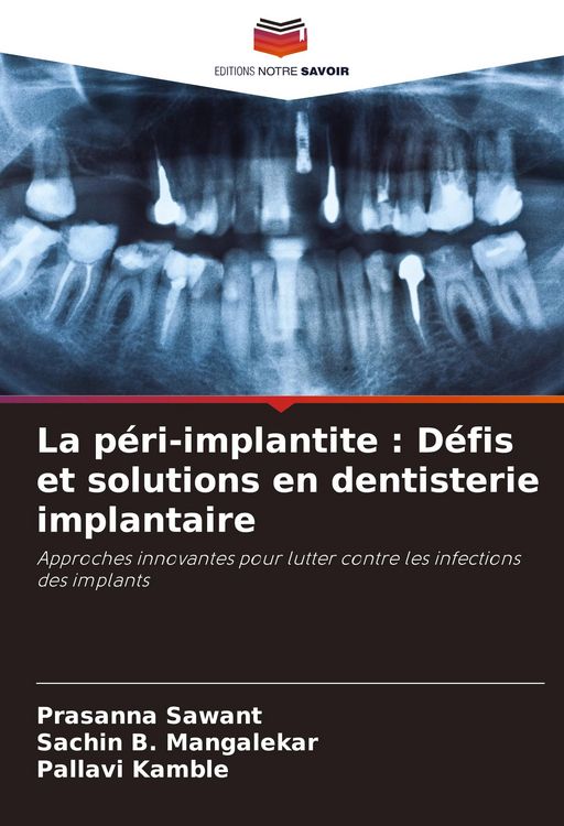 Produktbild: La p&eacute;ri-implantite : D&eacute;fis et solutions en dentisterie implantaire