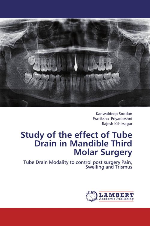 Produktbild: Study of the effect of Tube Drain in Mandible Third Molar Surgery