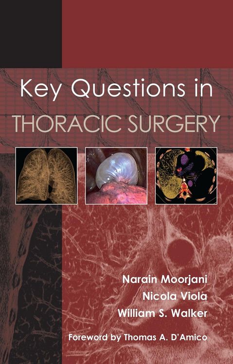 Produktbild: Key Questions in Thoracic Surgery