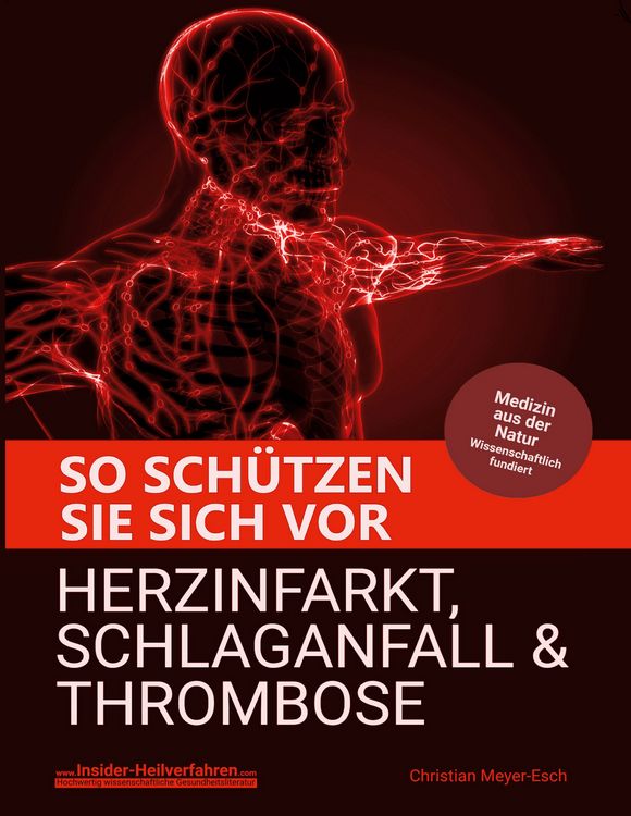 Produktbild: So sch&uuml;tzen Sie sich vor Herzinfarkt, Schlaganfall und Thrombose