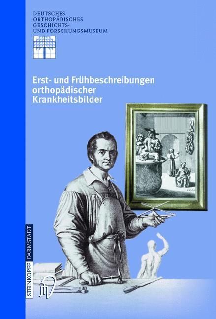 Produktbild: Erst- und Fr&uuml;hbeschreibungen orthop&auml;discher Krankheitsbilder