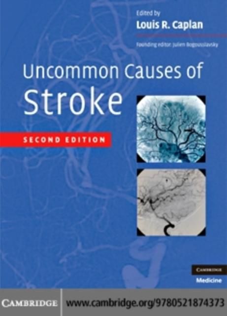 Produktbild: Uncommon Causes of Stroke