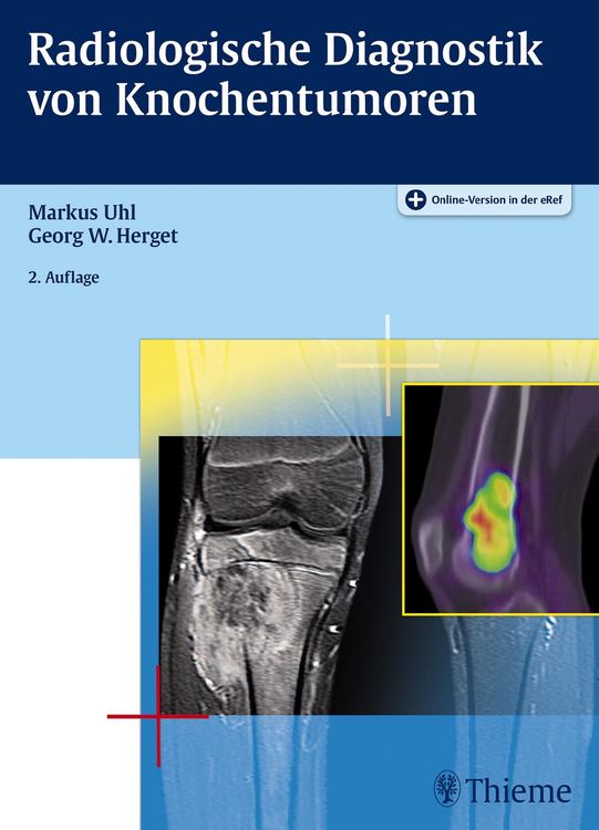 Produktbild: Radiologische Diagnostik von Knochentumoren