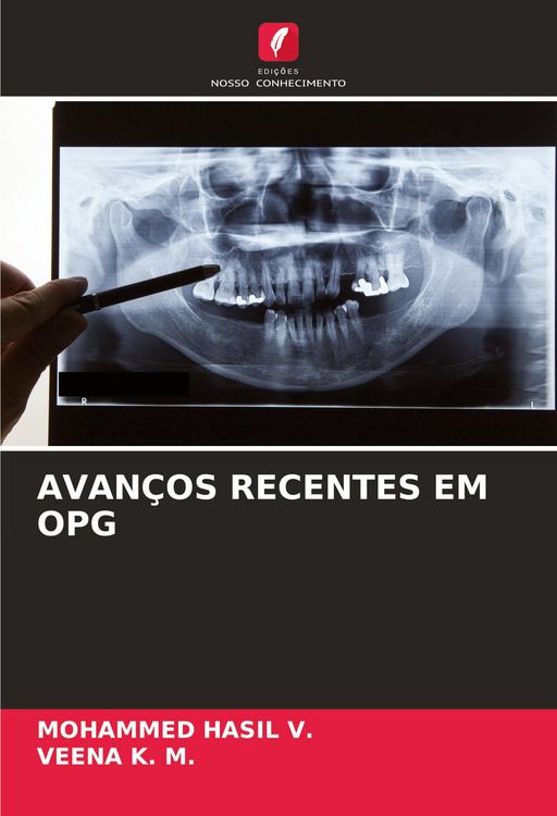 Produktbild: Avan&ccedil;os Recentes Em Opg