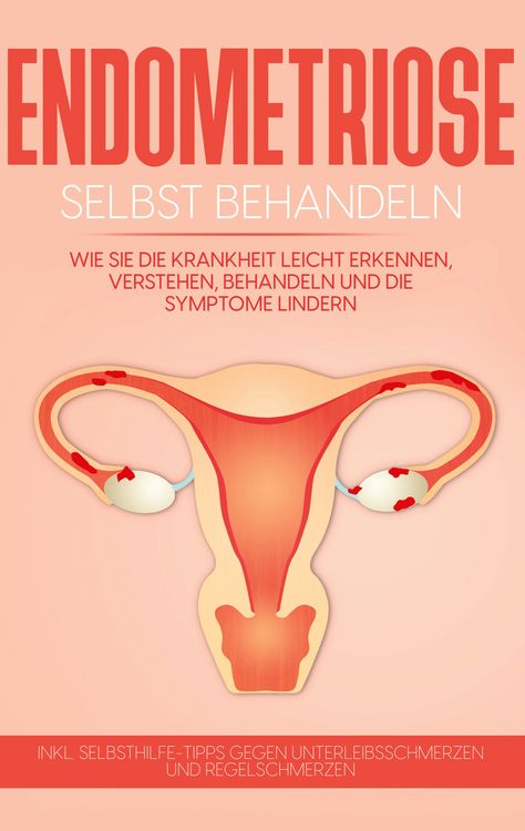 Produktbild: Endometriose selbst behandeln: Wie Sie die Krankheit leicht erkennen, verstehen, behandeln und die Symptome lindern - inkl. Selbsthilfe-Tipps gegen Unterleibsschmerzen und Regelschmerzen