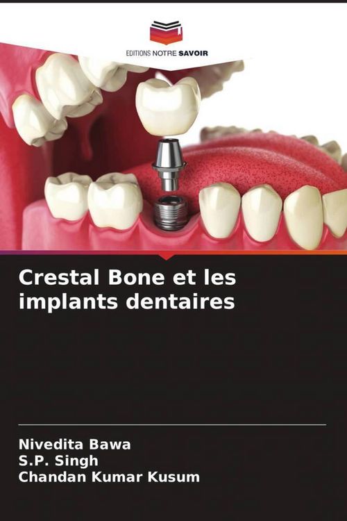 Produktbild: Crestal Bone et les implants dentaires
