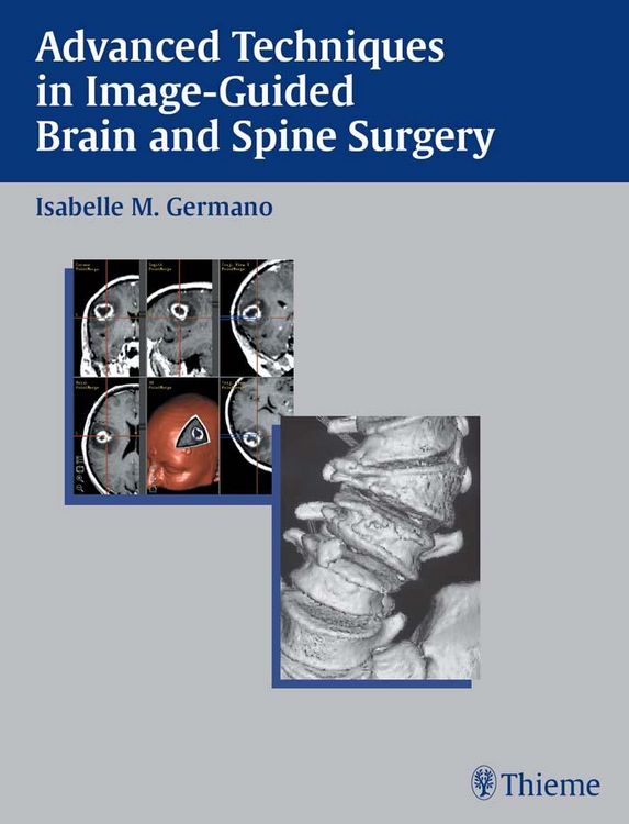 Produktbild: Advanced Techniques in Image-Guided Brain and Spine Surgery