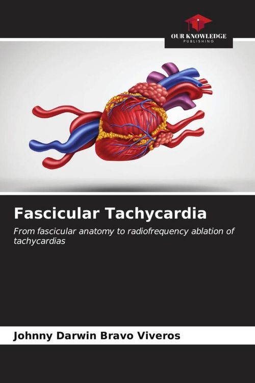 Produktbild: Fascicular Tachycardia