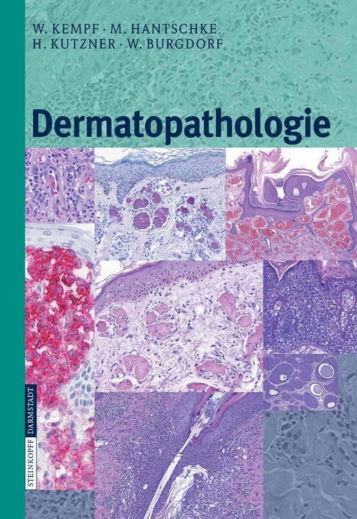 Produktbild: Dermatopathologie