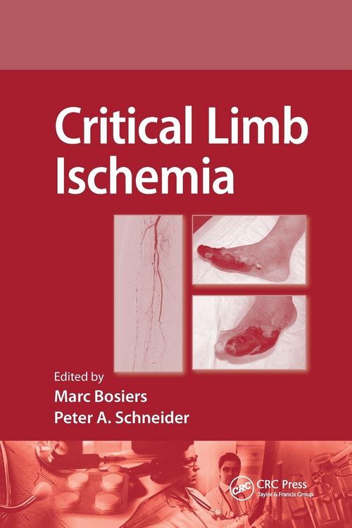 Produktbild: Critical Limb Ischemia