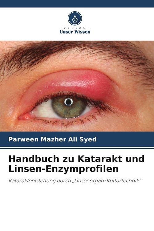 Produktbild: Handbuch zu Katarakt und Linsen-Enzymprofilen