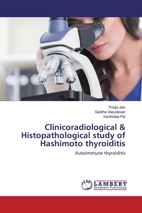 Produktbild: Clinicoradiological & Histopathological study of Hashimoto thyroiditis