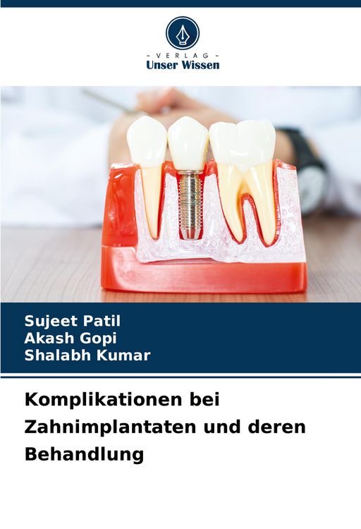 Produktbild: Komplikationen bei Zahnimplantaten und deren Behandlung