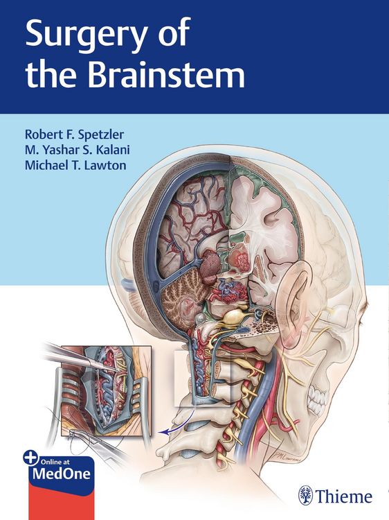 Produktbild: Surgery of the Brainstem