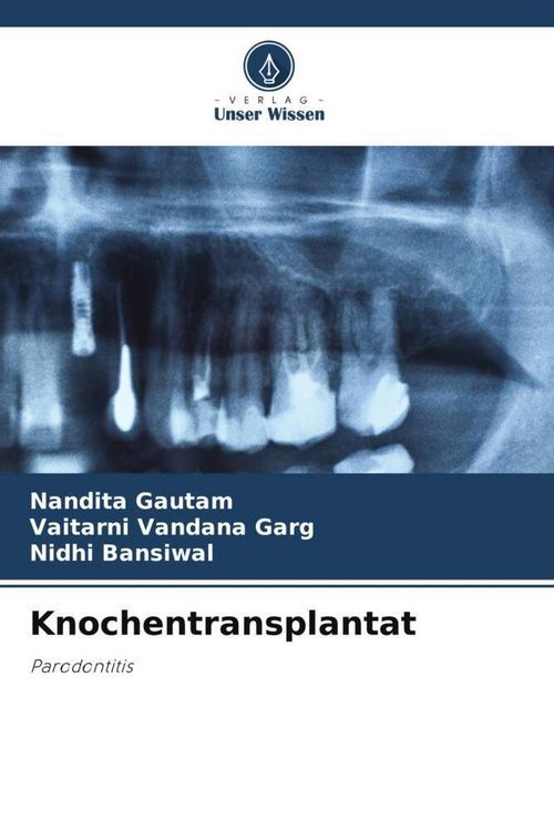 Produktbild: Knochentransplantat