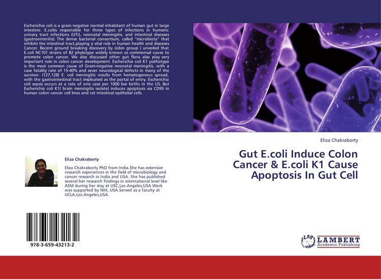 Produktbild: Gut E.coli Induce Colon Cancer & E.coli K1 Cause Apoptosis In Gut Cell