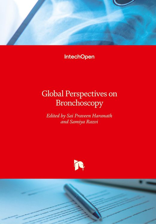 Produktbild: Global Perspectives on Bronchoscopy