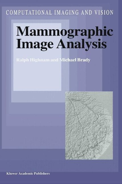 Produktbild: Mammographic Image Analysis