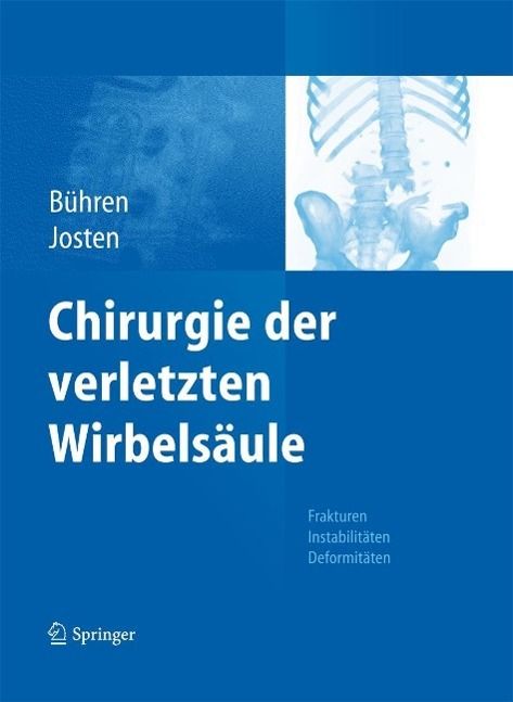Produktbild: Chirurgie der verletzten Wirbels&auml;ule