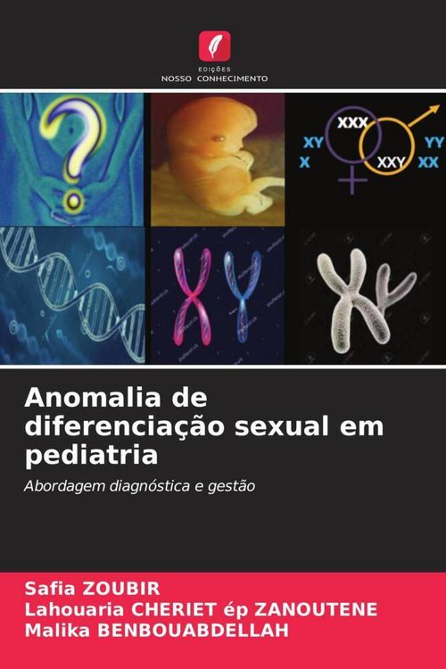 Produktbild: Anomalia de diferencia&ccedil;&atilde;o sexual em pediatria