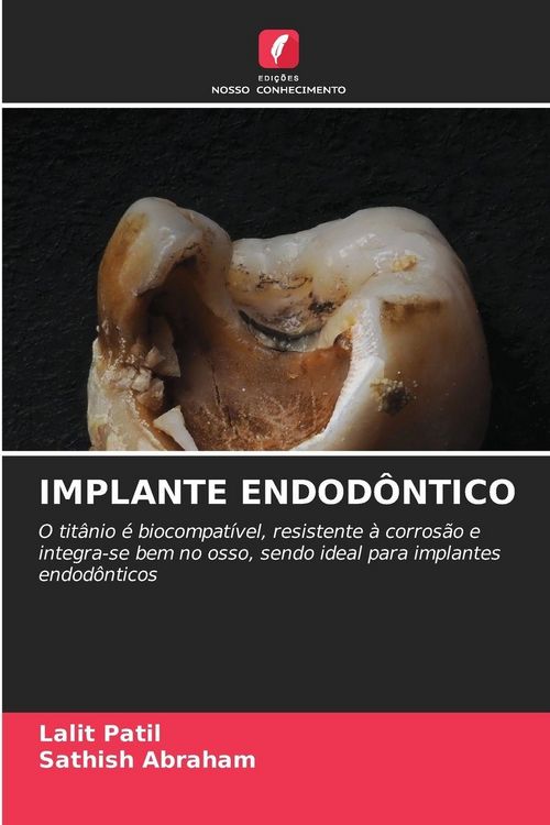 Produktbild: Implante Endod&ocirc;ntico