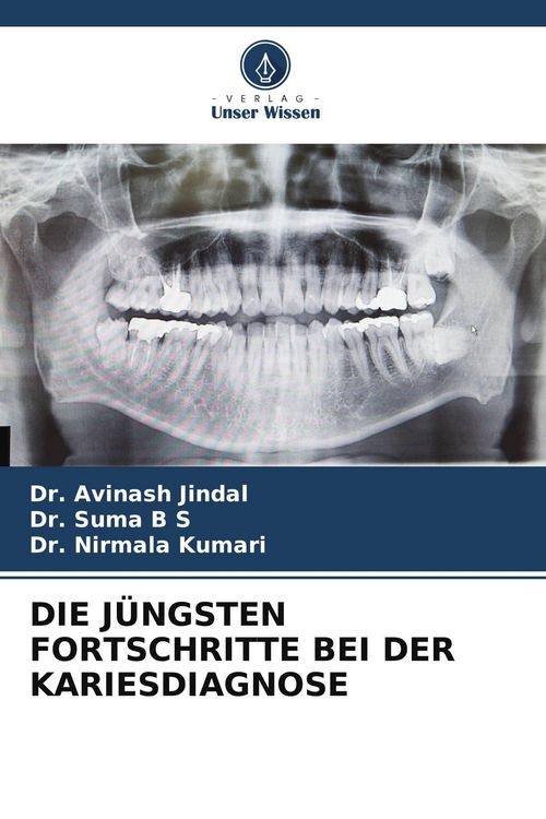 Produktbild: Die J&uuml;ngsten Fortschritte bei der Kariesdiagnose